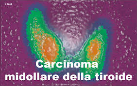 carcinoma midollare tiroideo